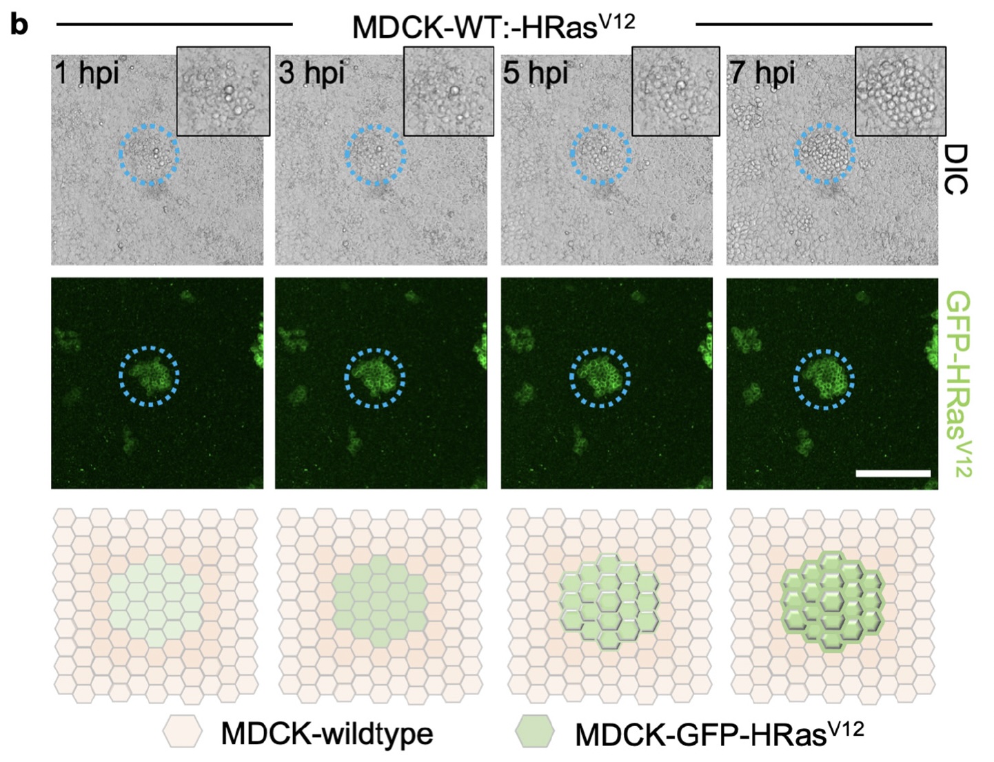 Physics of cancer - cell invasion